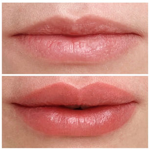 Before and after cosmetic lip tint result